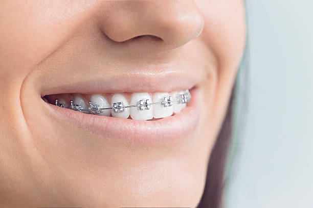 Dental Inlays and Onlays in Avery Creek, NC
